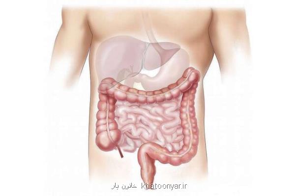 عامل های كلیدی در ابتلای زودهنگام به سرطان روده