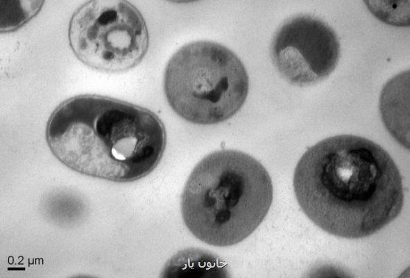 ثبت اولین مرگ بر اثر مبتلاشدن به ویروس خطرناک ماربورگ در آفریقا