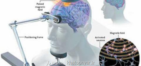 برگزاری كارگاه نقش تحریك الكتریكی مغز در توانبخشی بیماران مبتلا به سكته مغزی