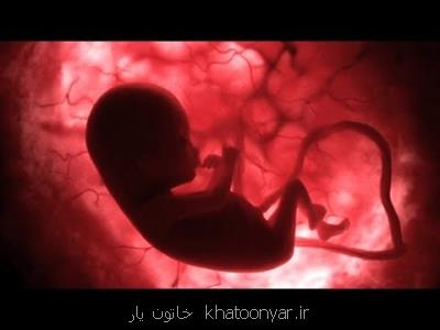 نمایشگاهی از تصاویر ۱۰۰۰ جنین
